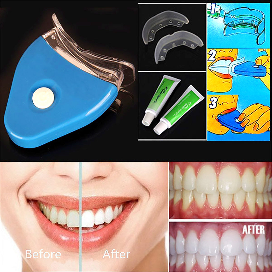 Oral GelTooth Whitening kit